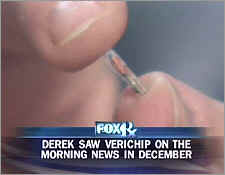 7_22_051002_microchip.jpg (10588 bytes)